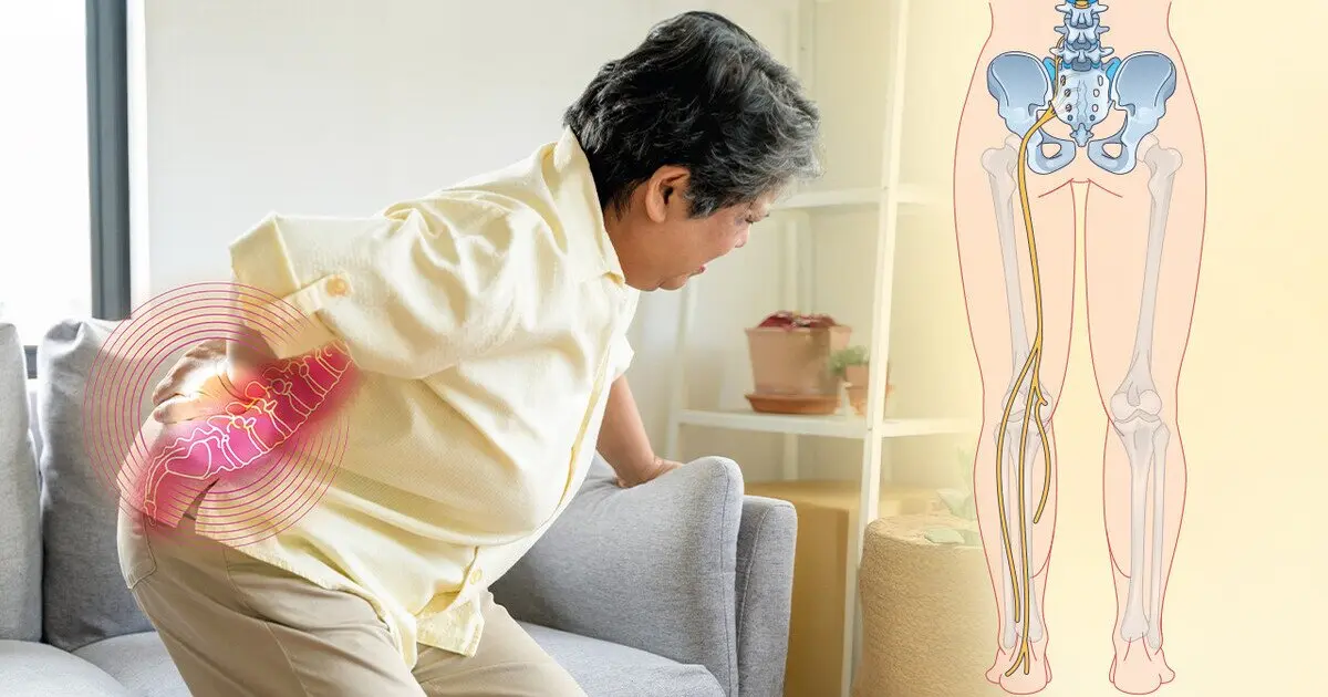 Sciatica Pain