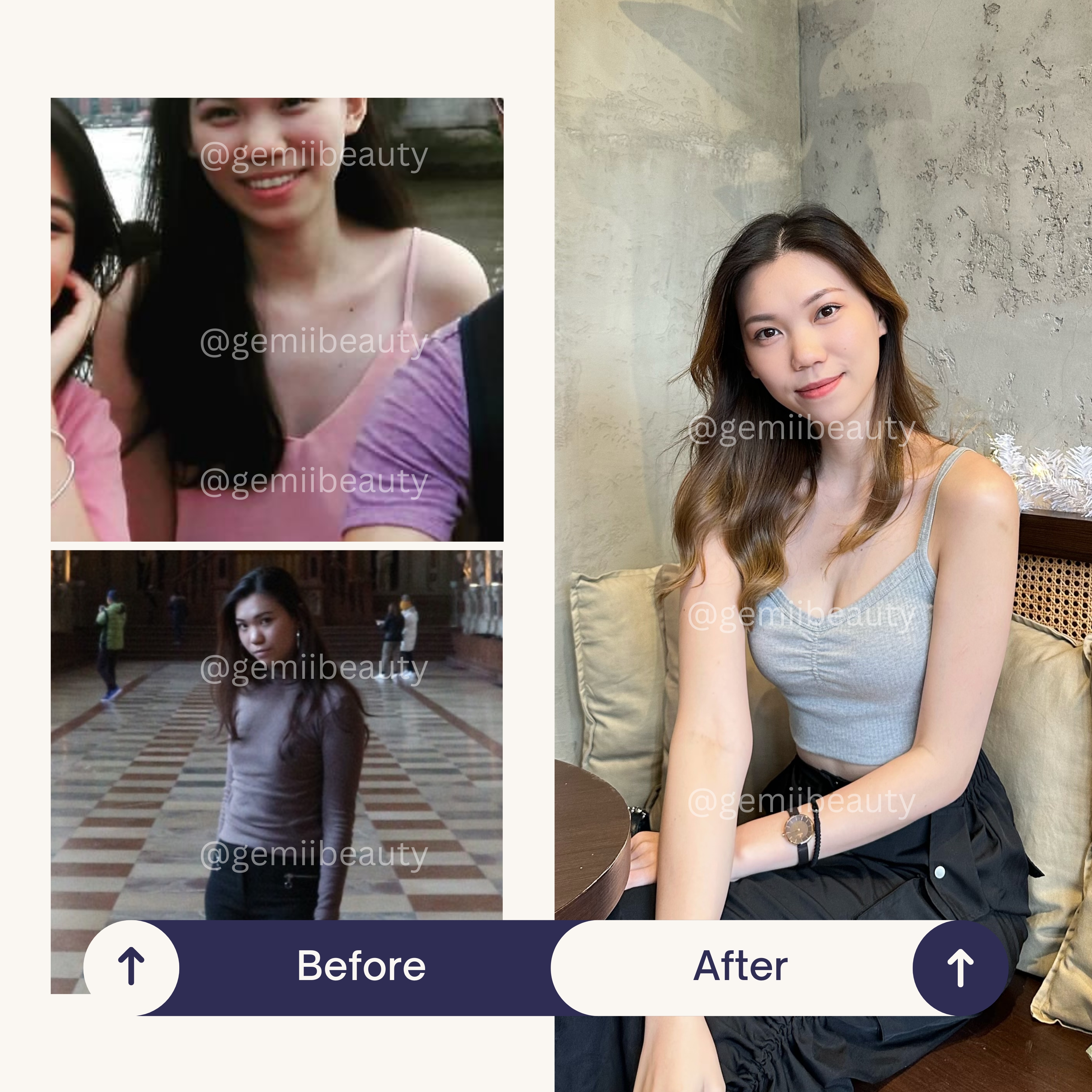 Before and After Testimonial
