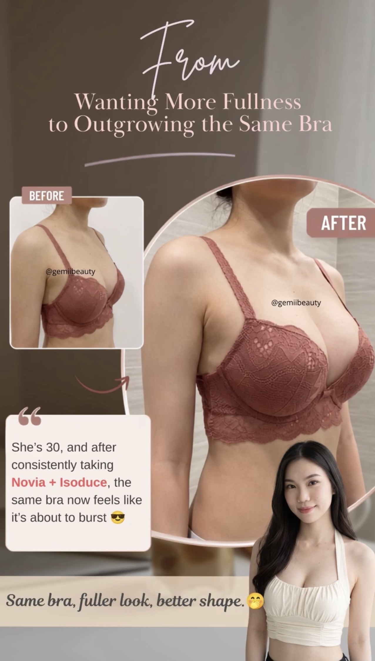 Customer story about upper chest fullness