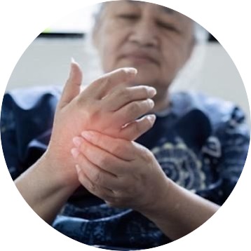 膽固醇高嚴重會出現手腳麻痺