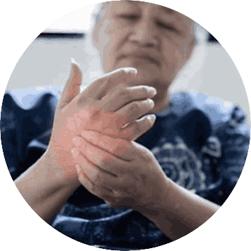 血糖高高嚴重會出現手腳麻痺