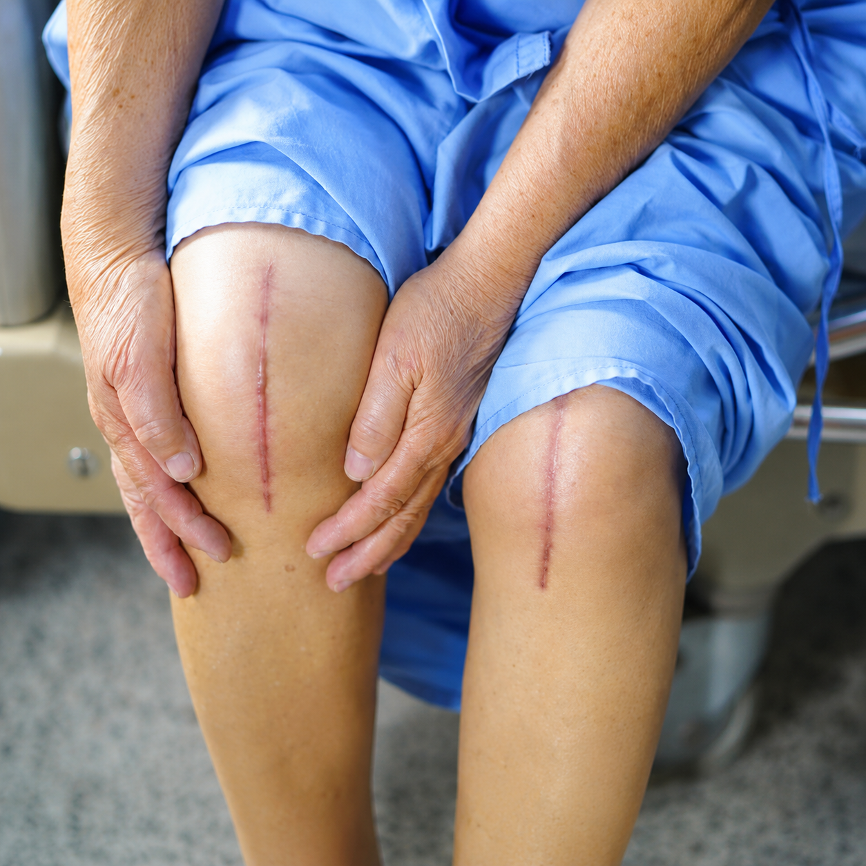 Knee Surgery Recovery
