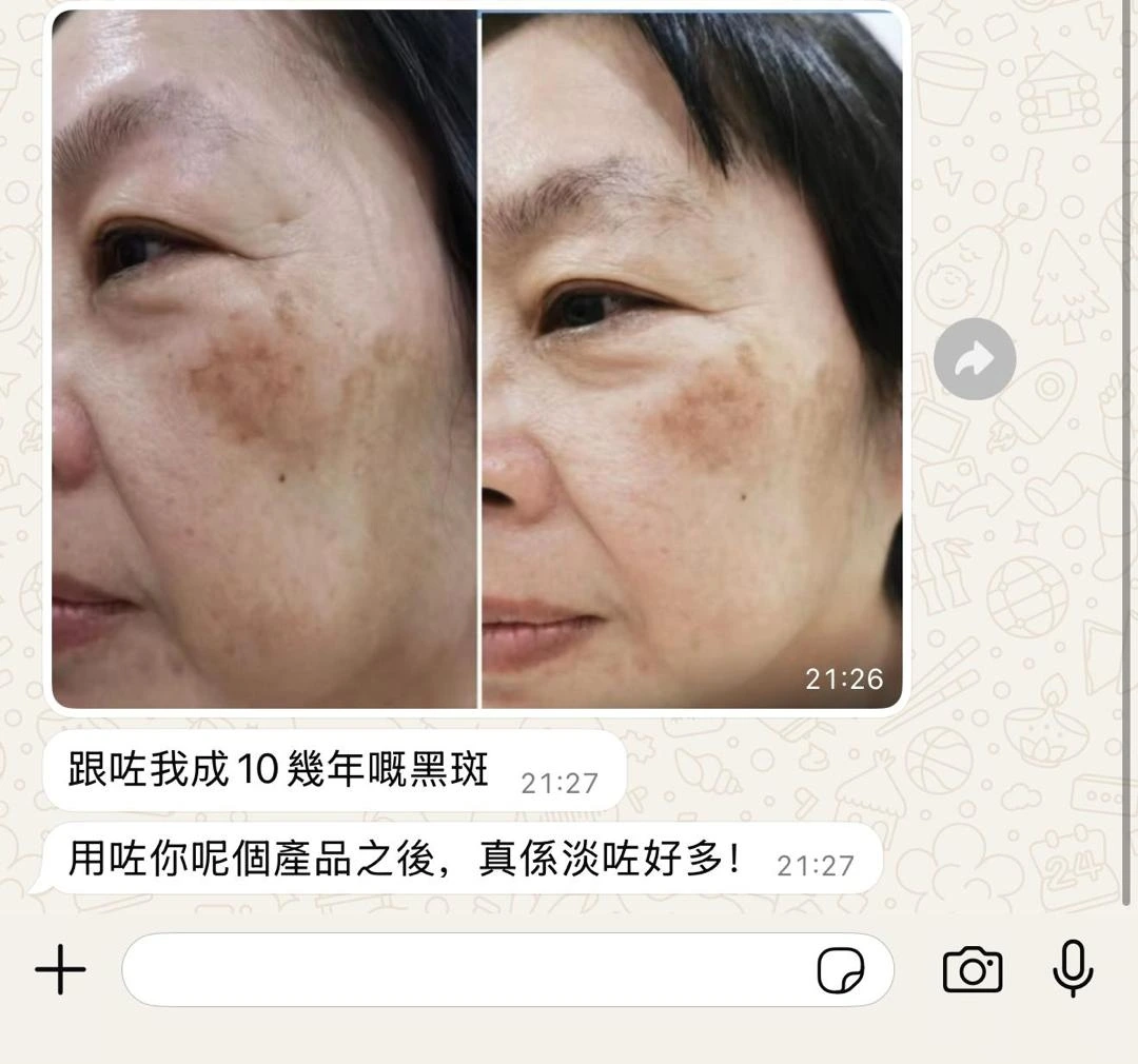 莫小姐 使用前後見證