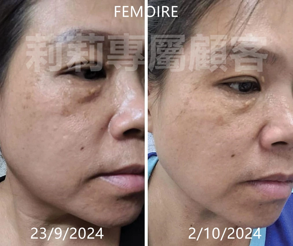 FEMOIRE 真實變化