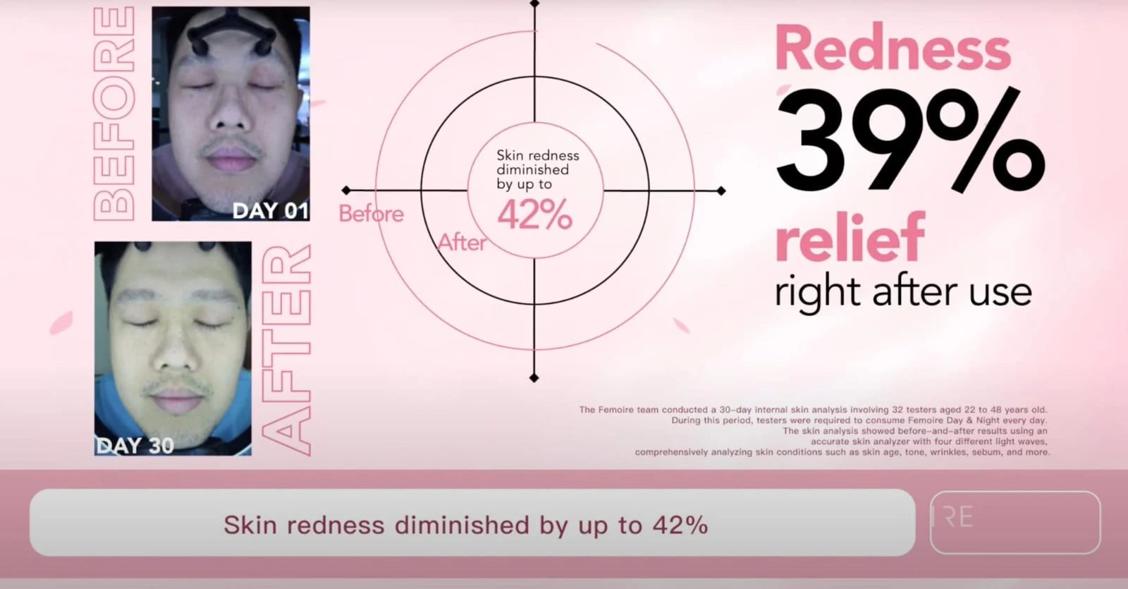 Redness Relief