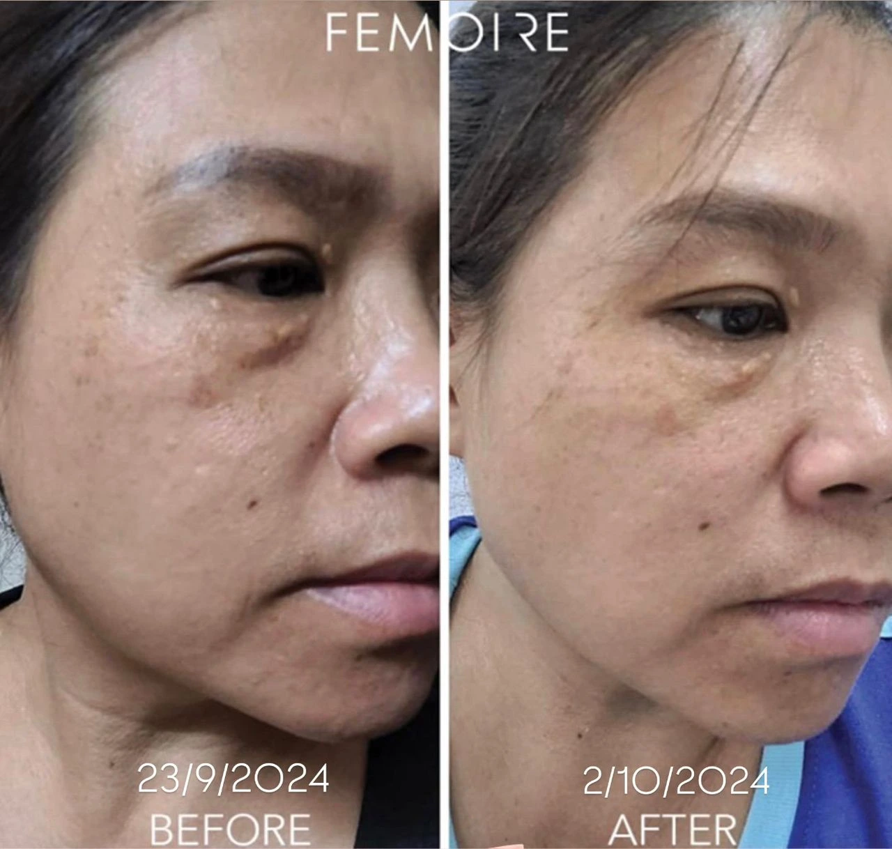 FEMOIRE Real Transformation
