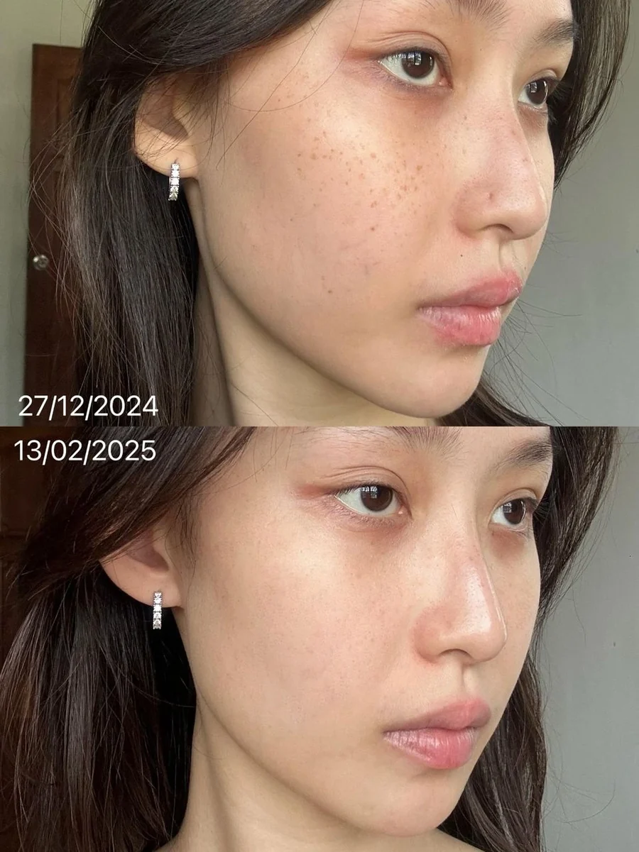 細妹 46 日真實轉變