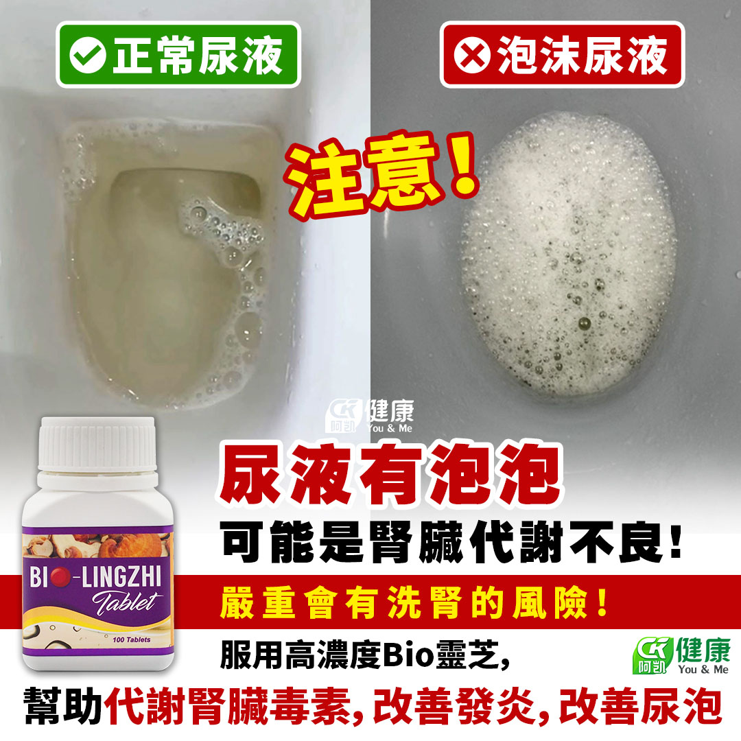 改善尿泡