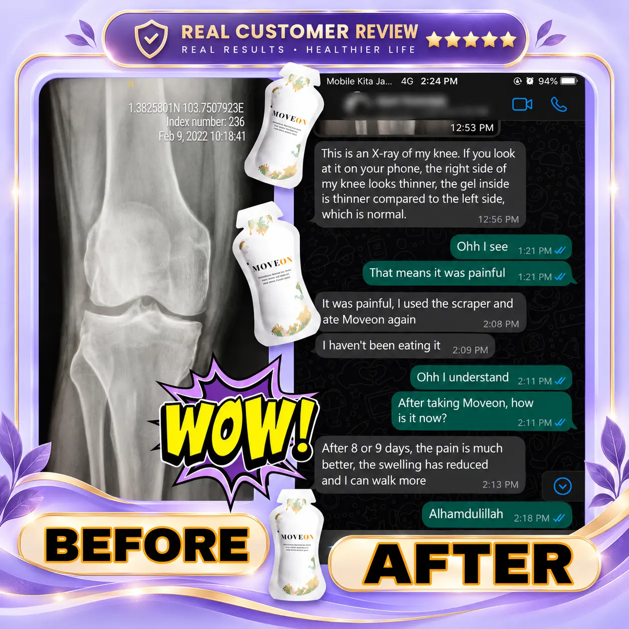 Customer with knee pain said the pain and swelling reduced after eight or nine days