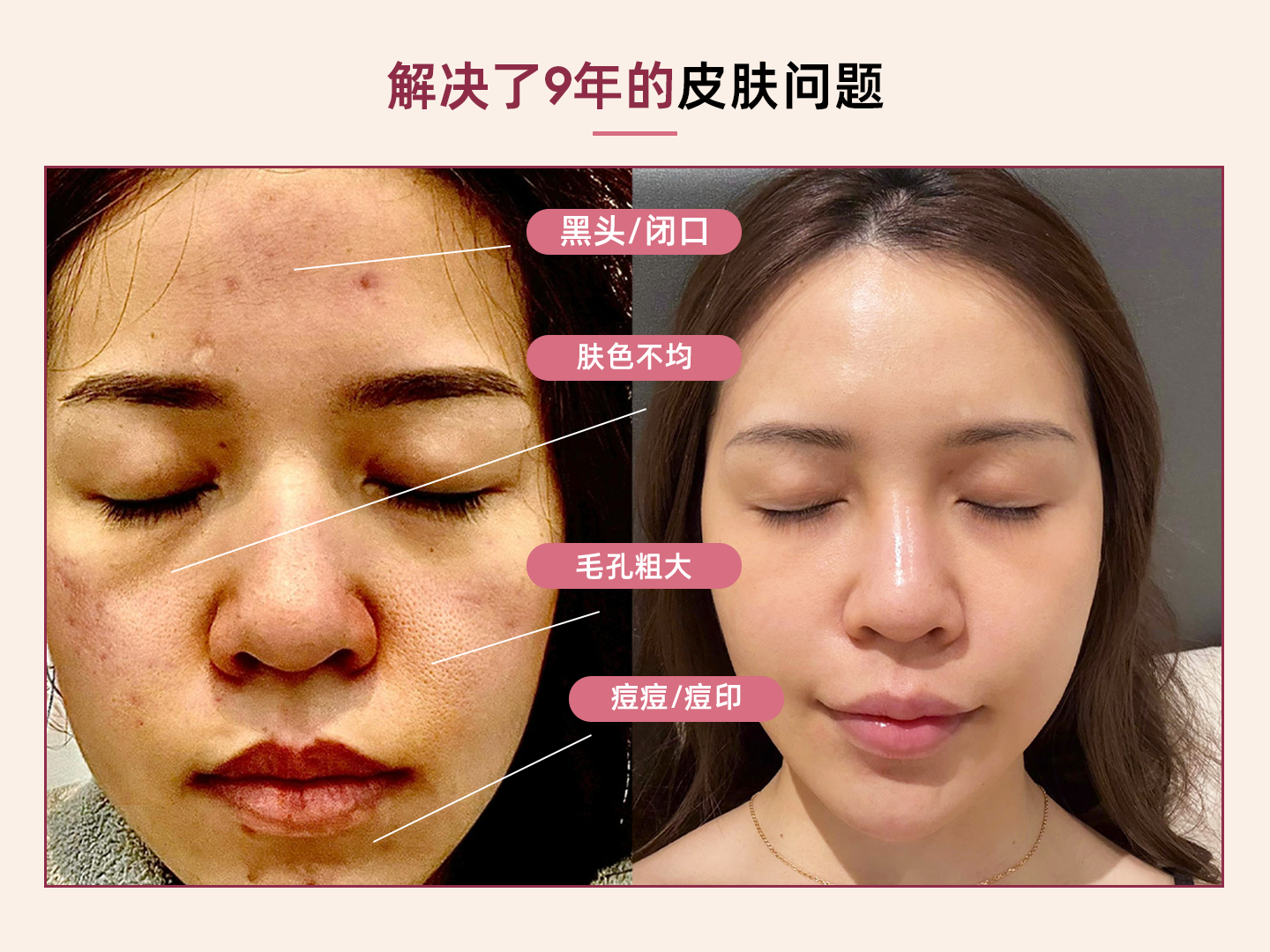 小婷前后对比