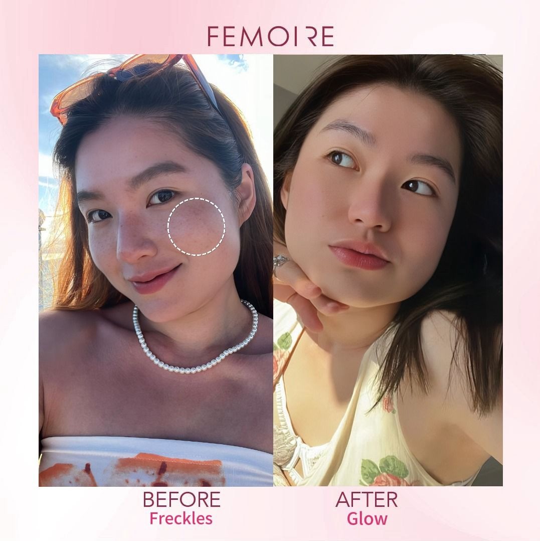 Before and After