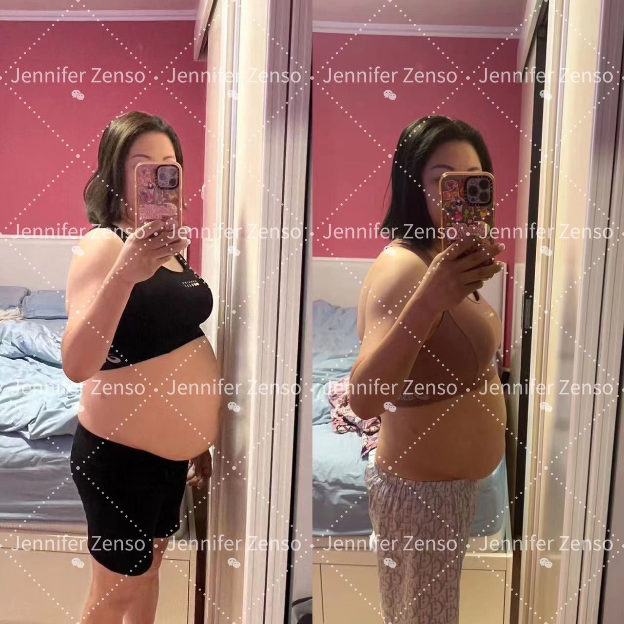 Before & After 8