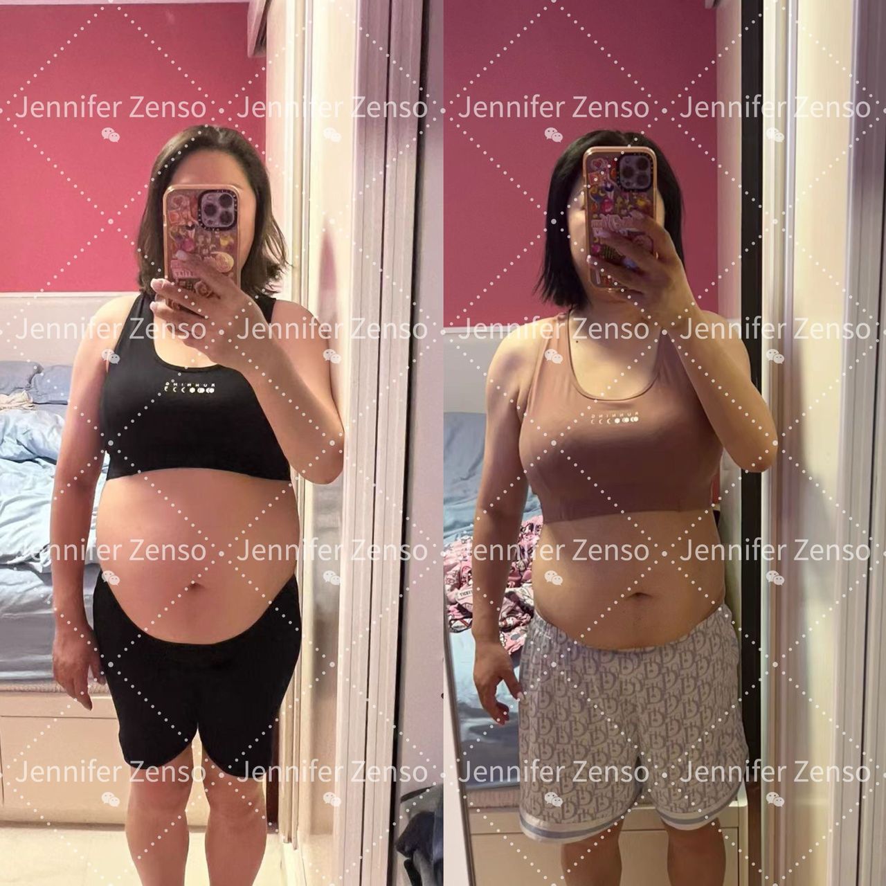 Before & After 7