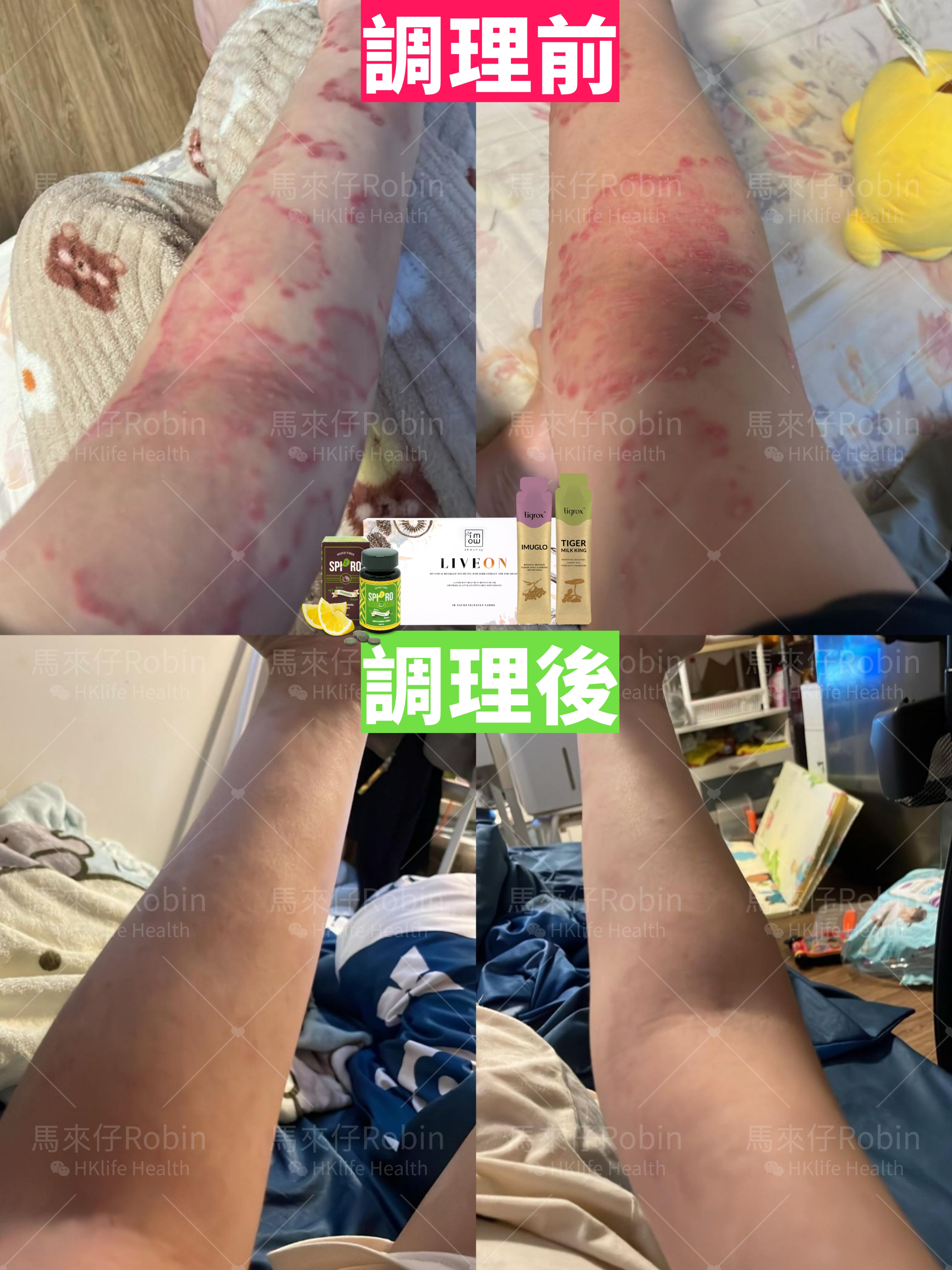 真實個案 11