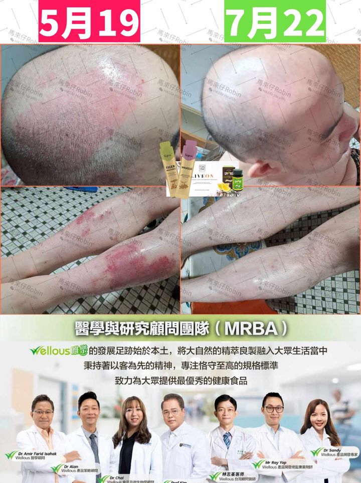 真實個案 10