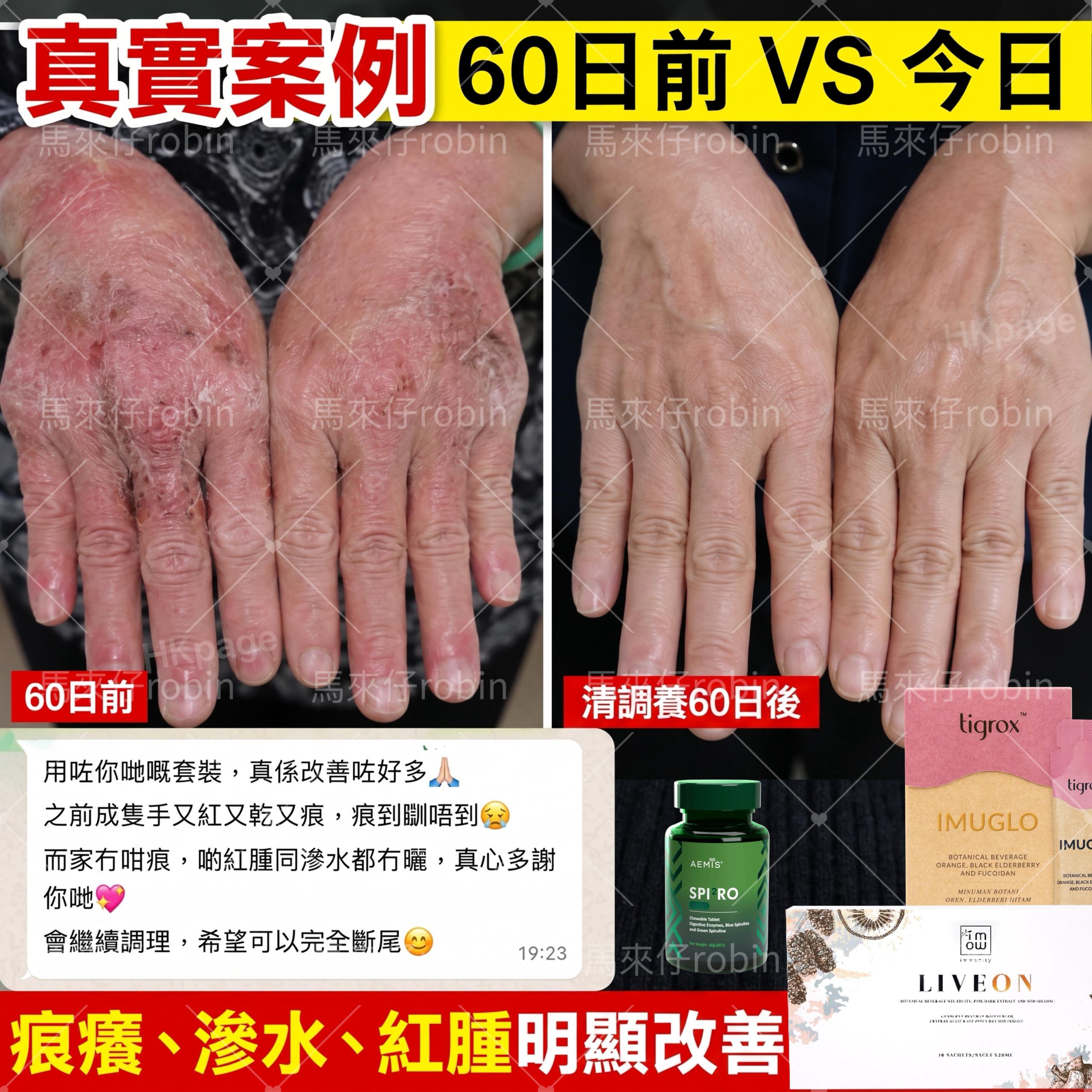 真實個案 4